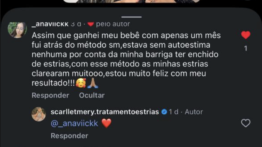 Mensagem de paciente recomendando o tratamento de estrias Método SM